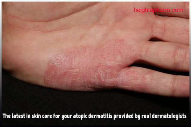 Dermatit Mediciner